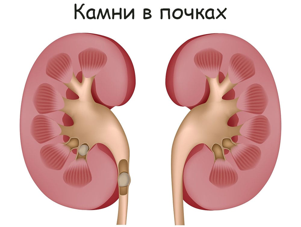 Кракен современный даркнет маркет плейс